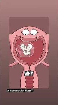 "Conjoined twins: 1 in 100,000 births #animation #maternalhealth
