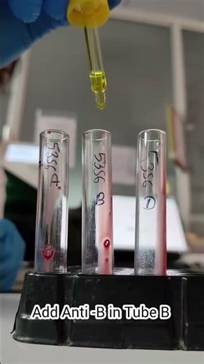 Blood Grouping by Tube Method | ABO & Rh Typing Explained #shorts