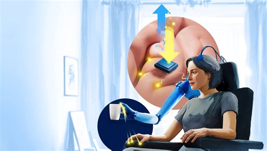 Sense Of Touch In Bionic Arm Hits “Another Level” Through Cutting-Edge Brain Stimulation