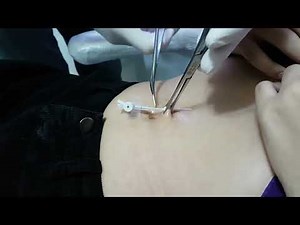 Navel Piercing Process Closeup #navel #piercing #viralvideo #trending #trendingvideo #educational