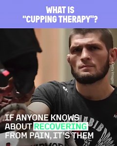 Why do players use cupping therapy? 🤔 | Magic Hands Creations