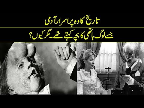 Facts About Elephant Man | Reality Facts