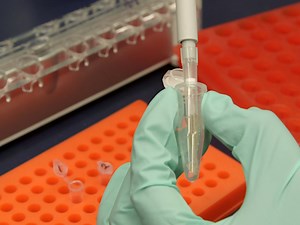 Amplicon-Based Bisulfite Conversion-NGS DNA Methylation Analysis Protocol - Watch Related Videos