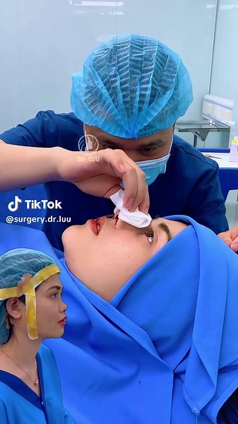 Straight nose bridge and high nose tip, that is the new nose shape that doctor Luu created for her. #rhinoplasty #facelift #malaysia #kualalumper #vietnam #trending #videoviral #drluu #surgery #plasticsurgery #cosmetics #aesthetic #viral