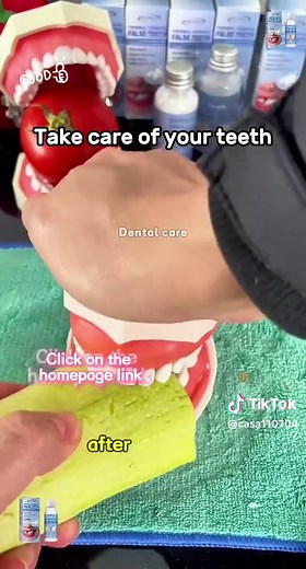 Cost of Tooth Repair: Fillings, Braces, and More