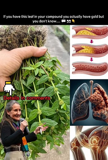 10K views · 25 reactions | If you have this leaf in your compound you actually have gold but you don't know.....  | Health Made Simple | Facebook