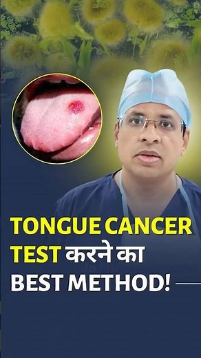 Types of Tongue Biopsy #drsumitshah #cancer #cancertreatment #tonguecancer #biopsytest #oralcancer