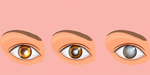 Are You At Risk For One Of These 5 Serious Eye Diseases?