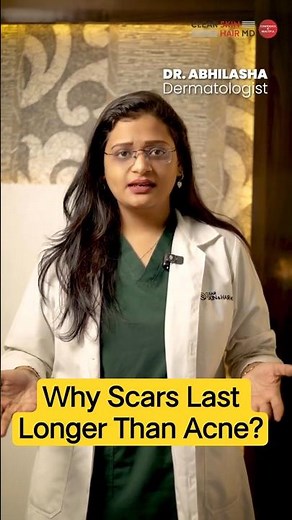 Acne Scar Treatment: Why Scars Last Longer Than Acne? | Clear Skin Clinic, Pune