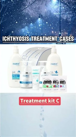 Effective ichthyosis treatment solve ichthyosis #ichthyosistreatment#ichthyosis#ichthyosisvulgaris