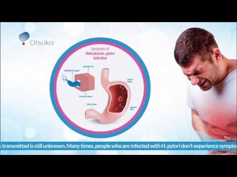 Otsuka Urea Breath Test Patient Information