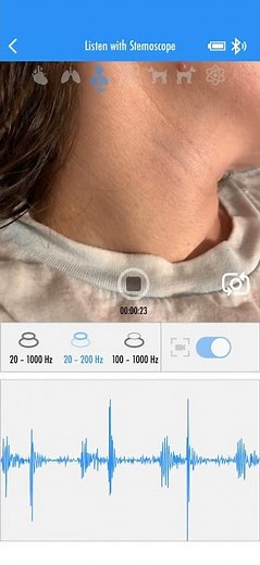 Recording her heartbeat sound with a stemoscope while watching her neck pulse