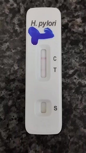 Understanding Helicobacter pylori Infection: Detection and Symptoms Explained