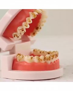 Um sorriso confiante que brilha✨ 👉 https://top.vigoshop.es/smily/t3/v1/lp3?utm_source=facebook&utm_medium=organic | vigoshop