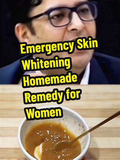 Emergency Skin Whitening Homemade Remedy for Women #skinwhitening #facecare #skincaretips #skincare #creatorsearchinsights