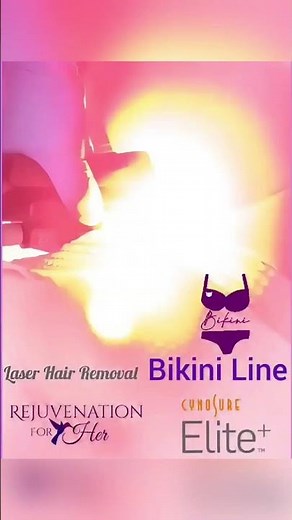 Bikini line - Elite laser hair removal
