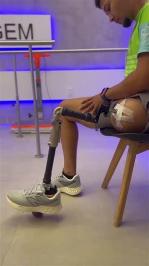 transfemoral amputte excellently walking in his prosthesis #painrelief #physiotherapy