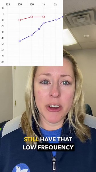 Recurrence of Cochlear Hydrops: My Ongoing Hearing Journey