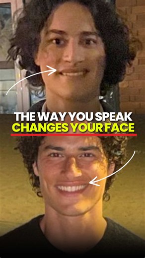 Our Voices Determines Our Faces #fascia #muscles #health #looks #oscarpatel - This content is for educational and informational purposes only and reflects what we have learned through years of client experience. It is not medical advice, diagnosis, or treatment, and is not a substitute for guidance from a qualified healthcare professional. Everything shared here is general information about structural health and facial development, not personalised advice for your specific situation. Always cons