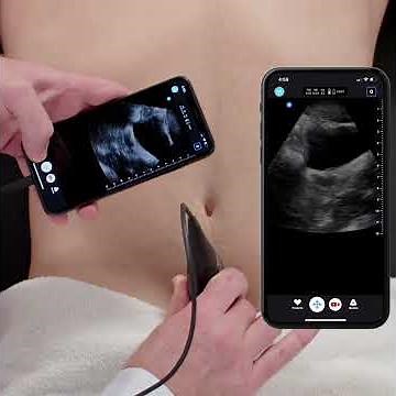 Ultrasound Education: FAST Exam Basics, Pelvic Window