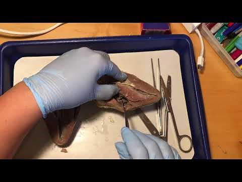Heart Dissection