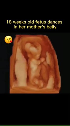 Baby in Womb GIF Funny - Dancing Fetus Updates