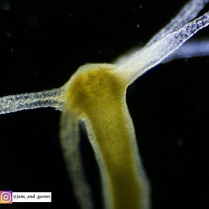 26 reactions | Hello everyone! This is a Hydra during reproduction...