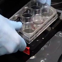 Video: In vitro Cell Migration and Invasion Assays