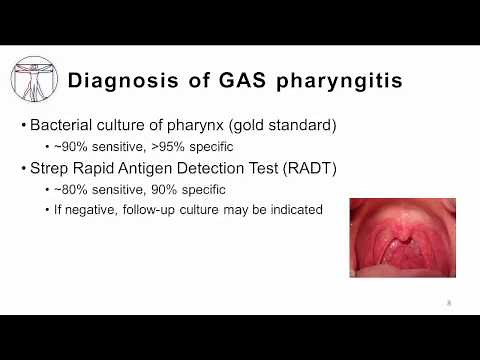 GAS pharyngitis: Diagnosis and Treatment