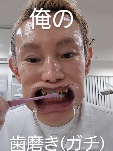 俺の歯磨きとセラミック矯正の全貌