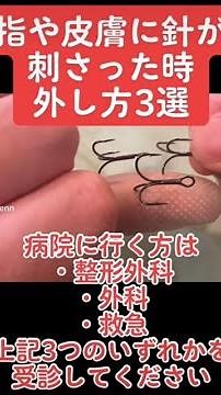針やジグの抜き方・対処法を３つ紹介。釣り針が刺さった時は「整形外科、外科、救急」に行き、保険適用で3,000円～5,000円が目安。保険証が無い方は全額自己負担で、1万円～16,000円だよ。