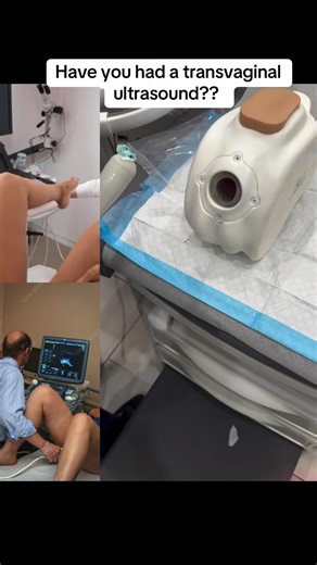 Understanding Transvaginal Ultrasound Benefits