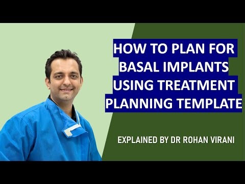 HOW TO PLAN FOR BASAL IMPLANTS USING TREATMENT PLANNING TEMPLATE - EXPLAINED BY DR ROHAN VIRANI