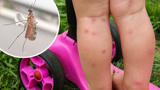 Surprising reason for midgie explosion on Coast