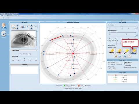 Tip Instructional – EyeSuite i9 Perimetry Performing a kinetic examination