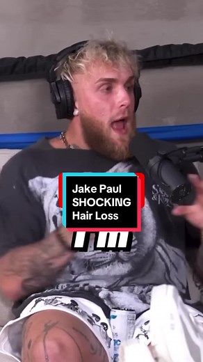 Jake Paul’s hair loss is being accelerated by his sport. Balding and hard training can go hand in hand. #jakepaul #balding #hairloss #hairgrowth #thinninghair #malepatternbaldness #androgenicalopecia #finasteride #minoxidil #dht #dihydrotestosterone #mensbalding #hairlinecheck #recedinghairline #hairlossjourney #ksi #loganpaul #primedrink #prime