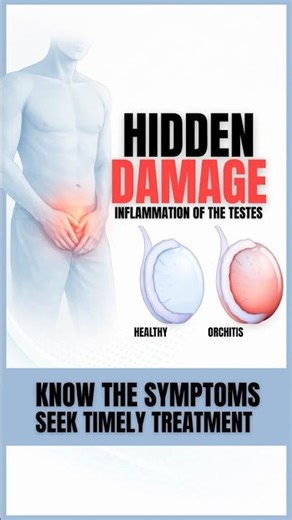 Male Fertility Risk | How Orchitis Damages Testicles | Testicular Inflammation #shorts