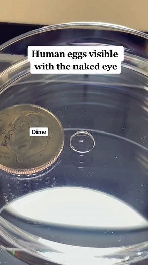 Human eggs visible with the naked eye... Isn't science amazing! 📹: @shaun.bob Did you know that eggs were this tiny? #ivfwarrior #thisisivf #ivfretrieval #eggretrieval #embryologist #embryology #ivf #ivfjourney #eggretrievalprocess