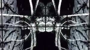 This beautiful imagery is a mosquito, captured by a scanning electron...