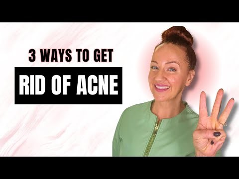 3 Habits That Actually Clear Acne (And Keep It Gone)