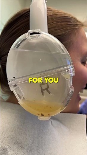 Special Headphones to Clean Your Ears At Home! 😍