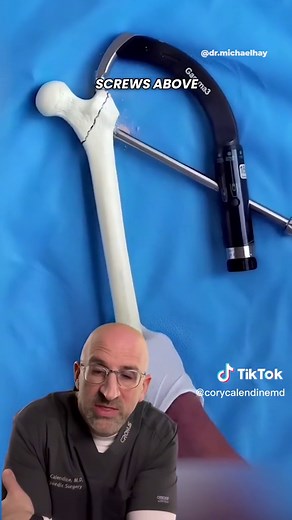 Understanding Hip Fractures in Older Adults: Risks and Recovery