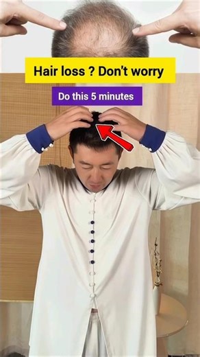 Hair fall problems 🚨🫵 don't worry #hairfall #haircare #shortsvideo #hairlosssolution