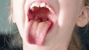 Wide open mouth with small uvula, palate and larynx. The child opened his mouth. Children's dentistry. Children's therapist, throat treatment. Overview of baby throat