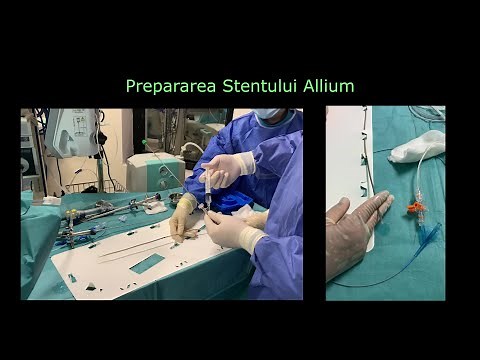 Allium Stent ureteral expandabil - Stenoza ureterala