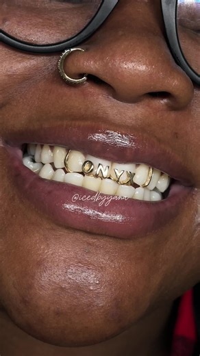 Grillz Appointments in Highland, Indiana