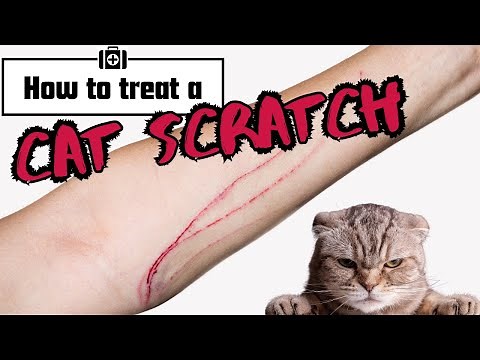 Cat Scratch Care: Essential Tips for Treating Scratches Safely