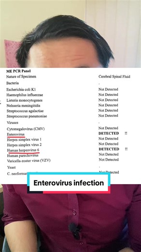 Enterovirus Infection in Babies | Rapid Deterioration and Treatment | Pediatrician's Experience