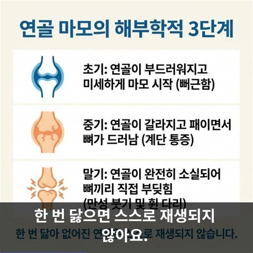 퇴행성 무릎 관절염 증상, 콘쥬란 연골 주사 스테로이드 뼈주사 부작용 무릎 한의원 치료
