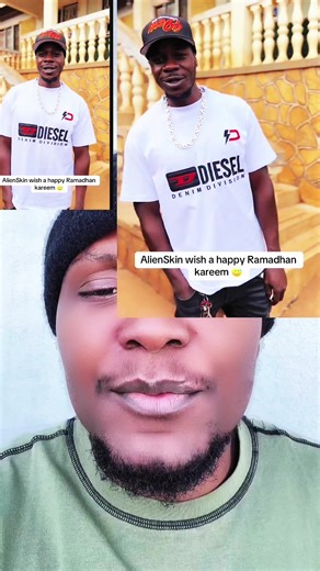 Alien Skin Ug #foryou #foryoupage @AlienSkin ug